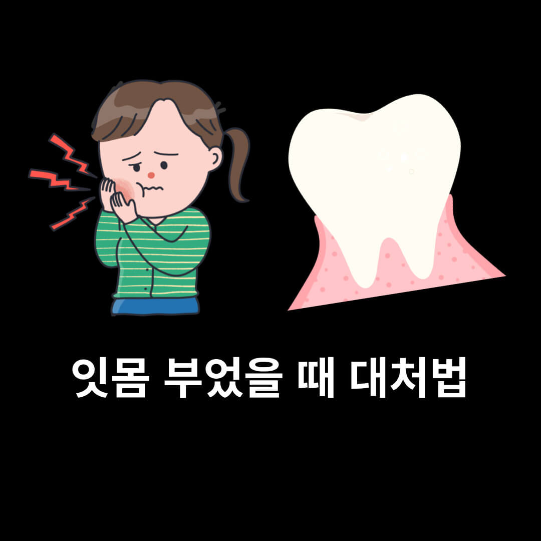 잇몸 부었을 때